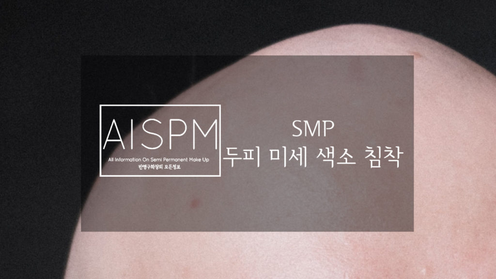 SMP 두피 미세 색소 침착